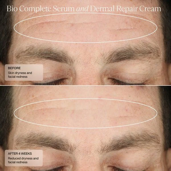 SENTÉ SENTÉ Bio Complete Serum (1 oz.) 5