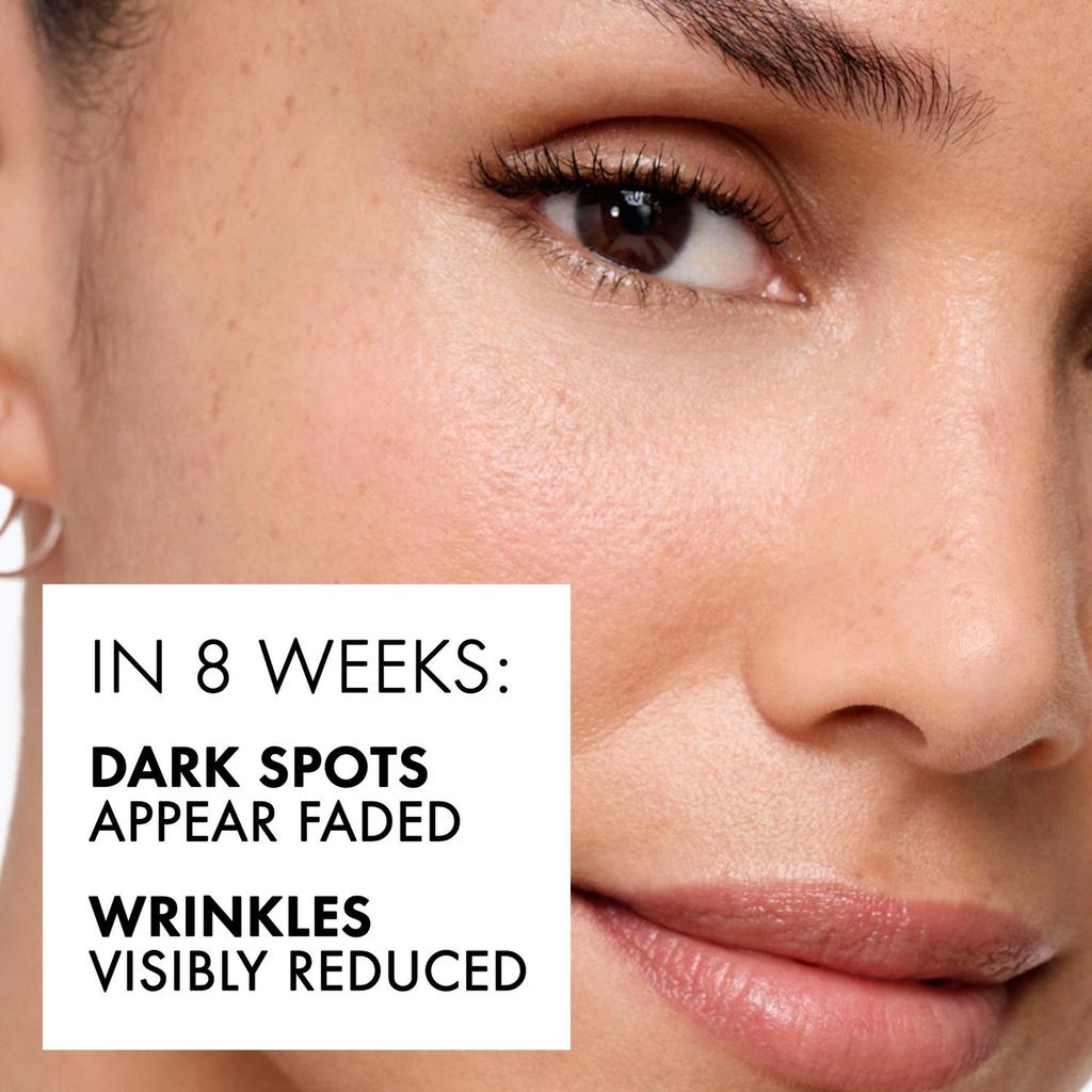 Vichy Vichy LiftActiv B3 Niacinamide Serum for Dark Spots and Wrinkles