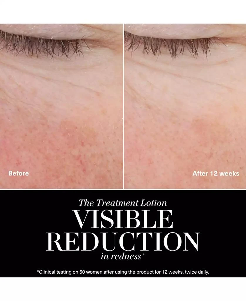 La Mer The Treatment Lotion for Hydration and Anti-Aging, 5 oz. 2