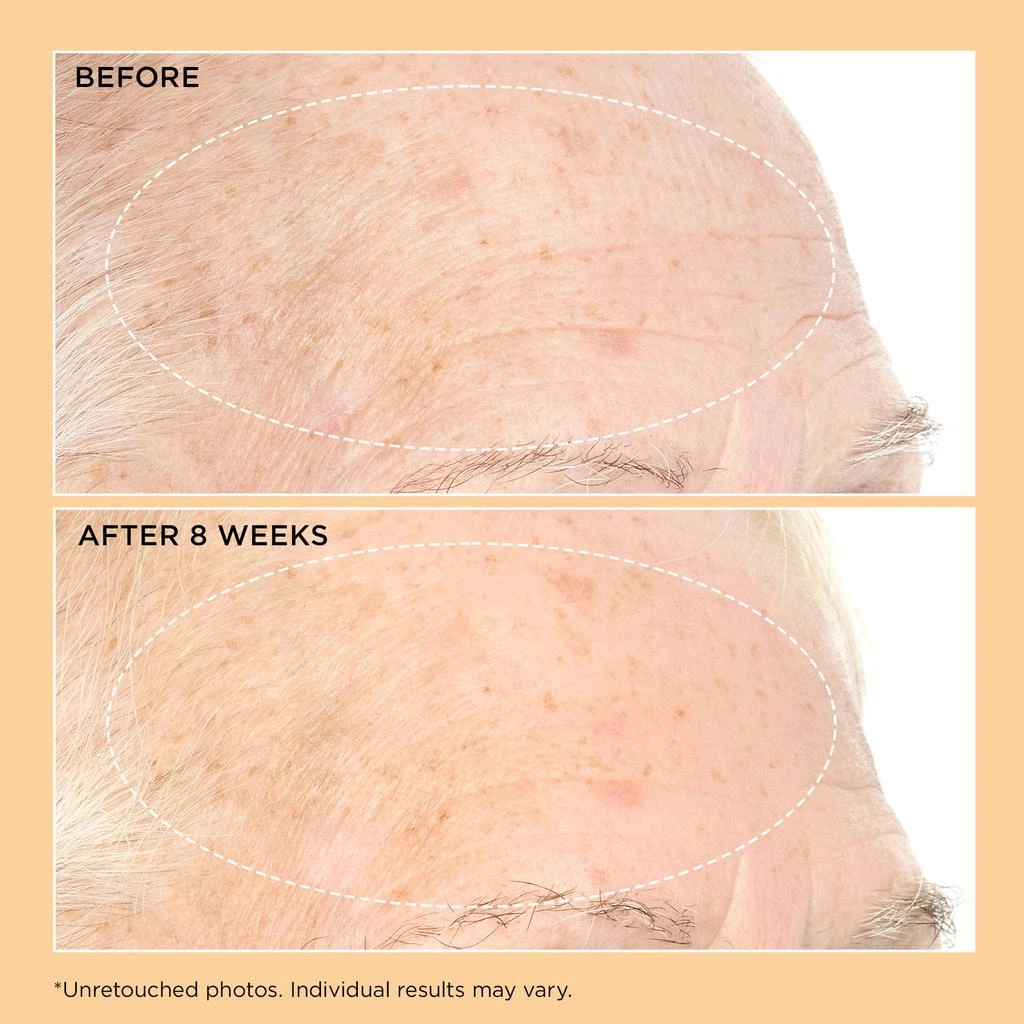 Perricone MD Neuropeptide Pro-Strength Firming Moisturizer 3